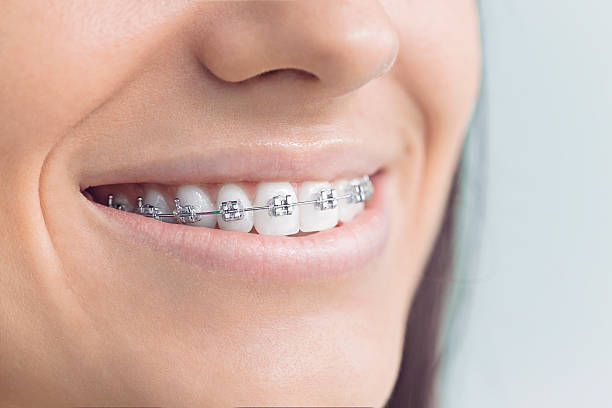 Oral Cancer Screening in Herndon, VA